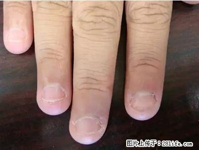 剪指甲、挖耳屎，这些日常小动作竟隐藏大危害！ - 揭阳生活资讯 - 揭阳28生活网 jy.28life.net